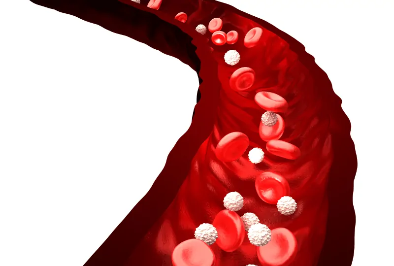 Причини за повишените нива на холестерол в кръвта