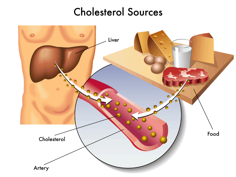 Холестерол - рискови фактори, превенция и лечение
