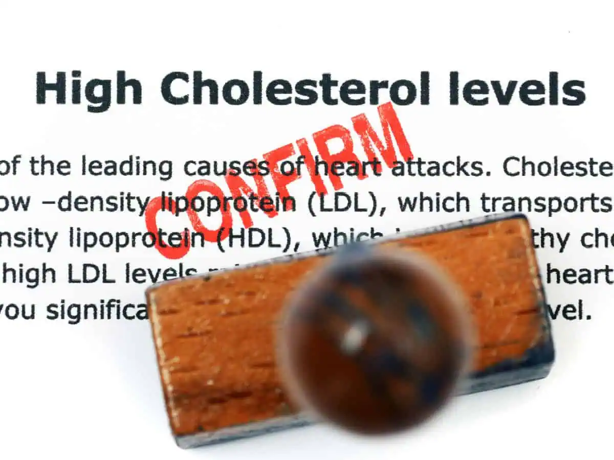 имам ли висок холестерол