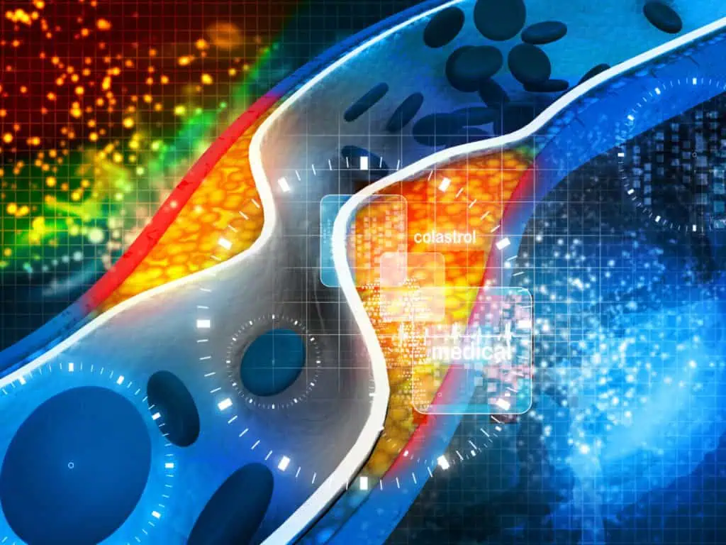 Митове за холестерола